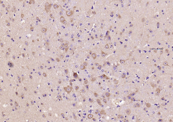 GSK-3 Beta Mouse Monoclonal Antibody