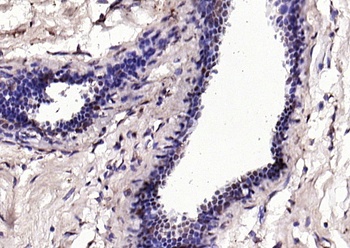 IRF-1 antibody