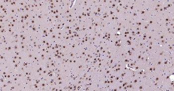AKT1 Recombinant Rabbit Monoclonal Antibody