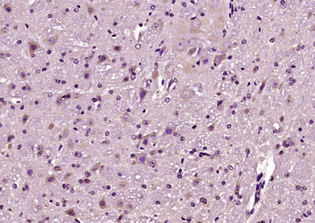 BRSK2 Rabbit Polyclonal Antibody