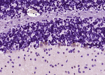 KIF3A Rabbit Polyclonal Antibody