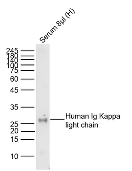 Human Ig Kappa light chain Mouse Monoclonal Antibody