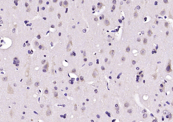 Synaptotagmin 1/SYT1 Rabbit Polyclonal Antibody