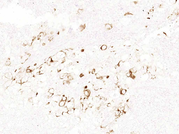Cytokeratin 19 Recombinant Rabbit Monoclonal Antibody