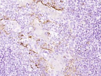 Cytokeratin 19 Recombinant Rabbit Monoclonal Antibody