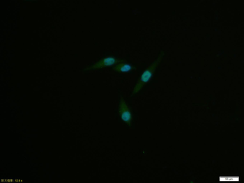 Phospho-MSK1 (Ser376) Recombinant Rabbit Monoclonal Antibody