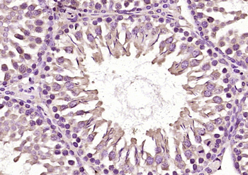 RSPO1 Rabbit Polyclonal Antibody