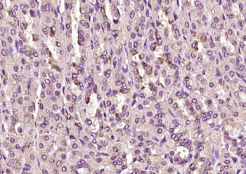 RSPO1 Rabbit Polyclonal Antibody