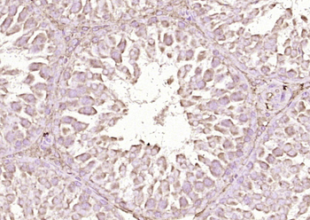 RSPO1 Rabbit Polyclonal Antibody