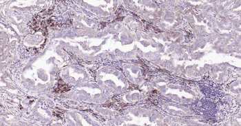 Cyclophilin B Mouse Monoclonal Antibody (Loading Control)