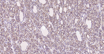 Cyclophilin B Mouse Monoclonal Antibody (Loading Control)
