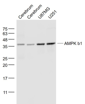AMPK b1 Mouse Monoclonal Antibody