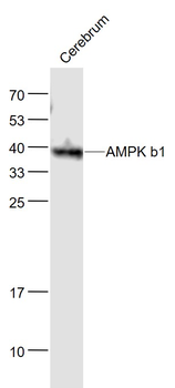 AMPK b1 Mouse Monoclonal Antibody