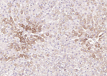 Ox-LDL Mouse Monoclonal Antibody