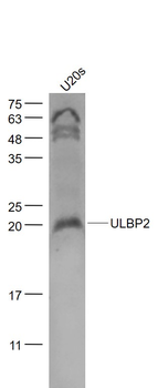 ULBP2 Rabbit Polyclonal Antibody