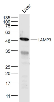 LAMP3 Rabbit Polyclonal Antibody