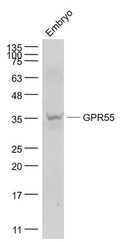 GPR55 Rabbit Polyclonal Antibody