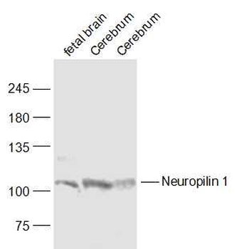 Neuropilin 1 Rabbit Polyclonal Antibody