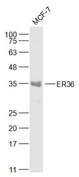 ER36 Rabbit Polyclonal Antibody