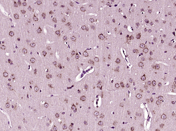 Heme Oxygenase 1 Rabbit Polyclonal Antibody