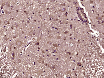 SLC22A4 Rabbit Polyclonal Antibody