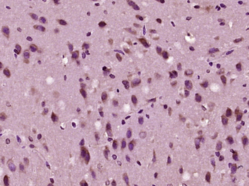 ADAMTS10 Rabbit Polyclonal Antibody