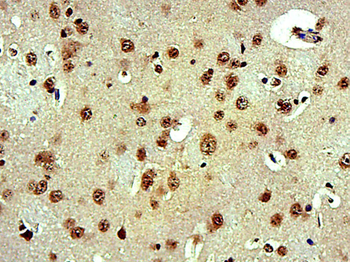 FAM193B Rabbit Polyclonal Antibody