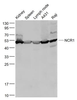 NCR1 Rabbit Polyclonal Antibody