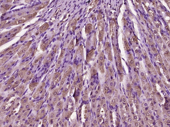TFF2 Rabbit Polyclonal Antibody