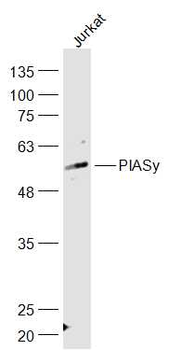 PIAS4/PIASy Rabbit Polyclonal Antibody