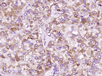 Collagen II Mouse Monoclonal Antibody