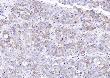 Collagen II Mouse Monoclonal Antibody