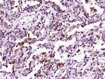 Collagen II Mouse Monoclonal Antibody