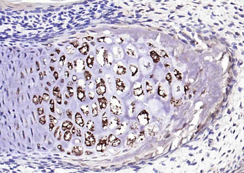 Collagen II Mouse Monoclonal Antibody