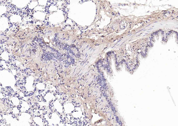 Collagen II Mouse Monoclonal Antibody