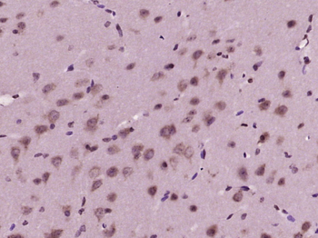 IRE1 Rabbit Polyclonal Antibody