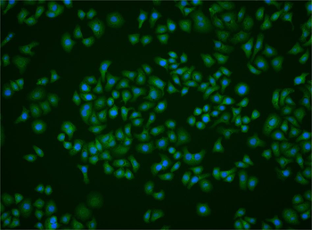 BNC1 Rabbit Polyclonal Antibody