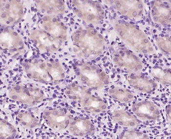 BNC1 Rabbit Polyclonal Antibody