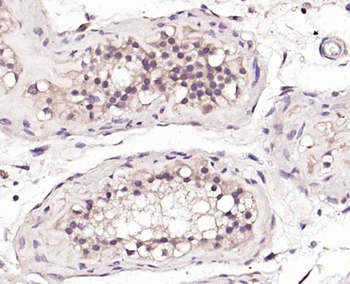 BNC1 Rabbit Polyclonal Antibody