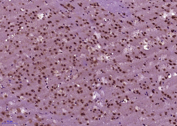 BNC1 Rabbit Polyclonal Antibody