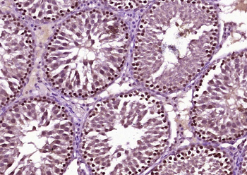 BNC1 Rabbit Polyclonal Antibody