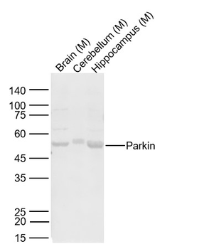 Parkin Rabbit Polyclonal Antibody