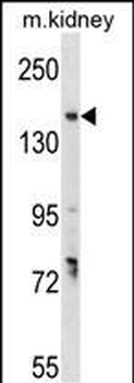GREB1 Rabbit Polyclonal Antibody