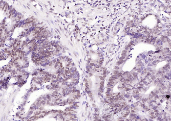 Phospho-GSK-3 Beta (Ser21+Ser29) Rabbit Polyclonal Antibody
