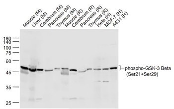 GSK-3 Beta (phospho-Ser21/Ser29) antibody