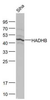 HADHB Rabbit Polyclonal Antibody