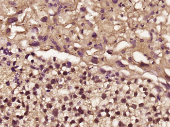 FHL2 Rabbit Polyclonal Antibody