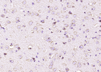 PTN Rabbit Polyclonal Antibody