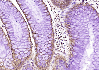 MAP3K9 Rabbit Polyclonal Antibody