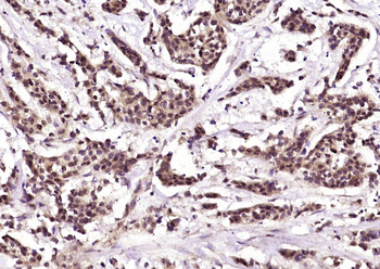MAP3K9 Rabbit Polyclonal Antibody